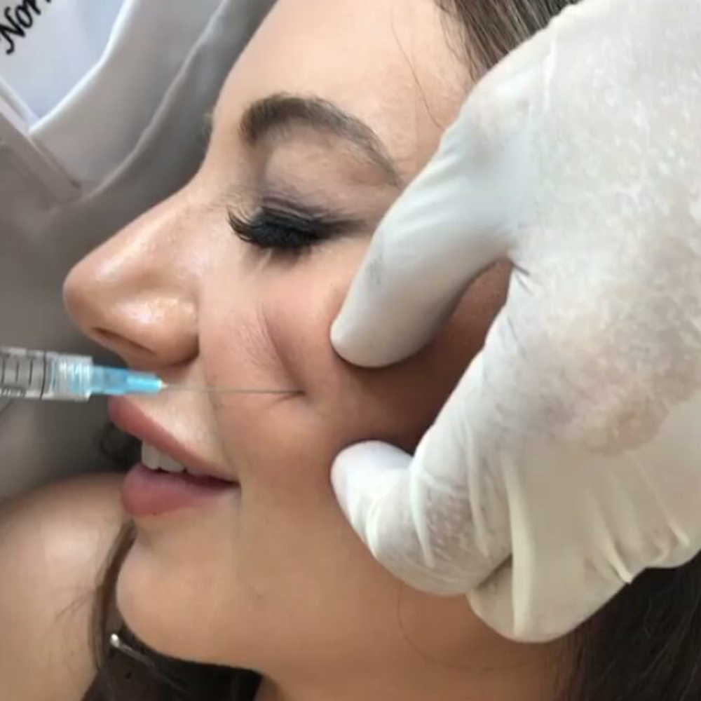 Juv茅derm Voluma in NJ and NY