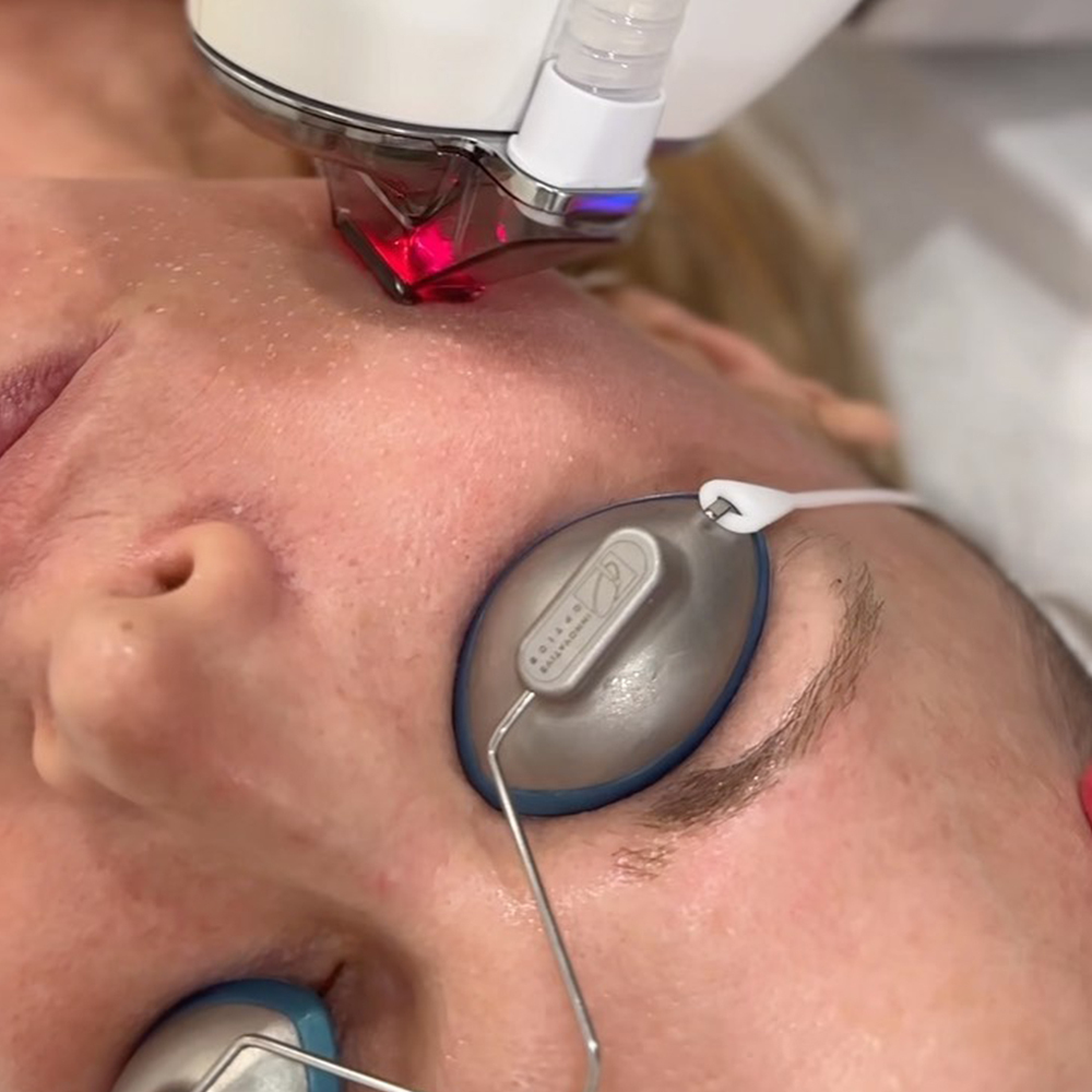 Pixel Laser Skin Resurfacing in NJ and NY