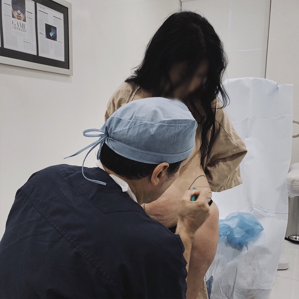 ThermiTight in NJ and NY